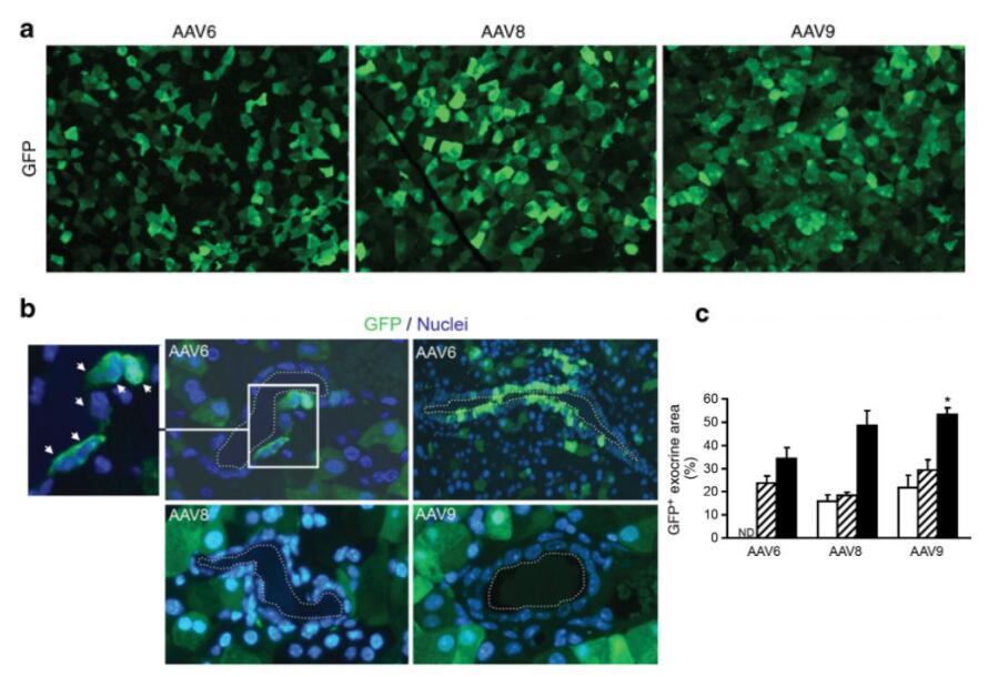 不同血清型的AAV-CAG-GFP通过导管注射对胰脏腺泡细胞进行感染