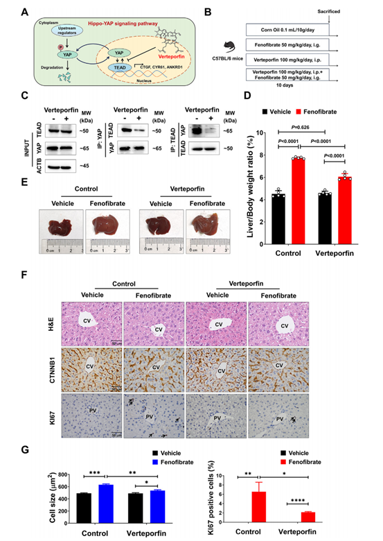 抑制YAP-TEAD互作减弱非诺贝特诱导的肝增大