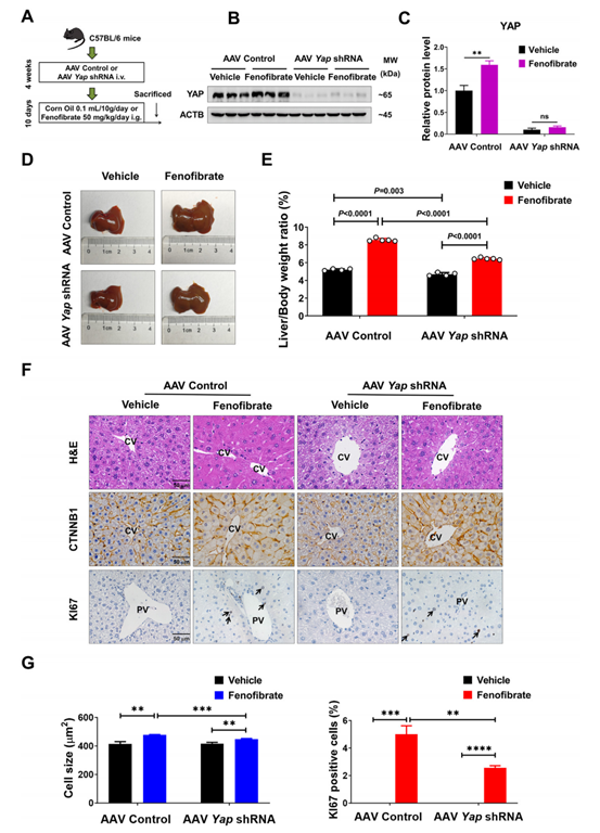 敲低肝脏YAP抑制非诺贝特诱导的肝增大