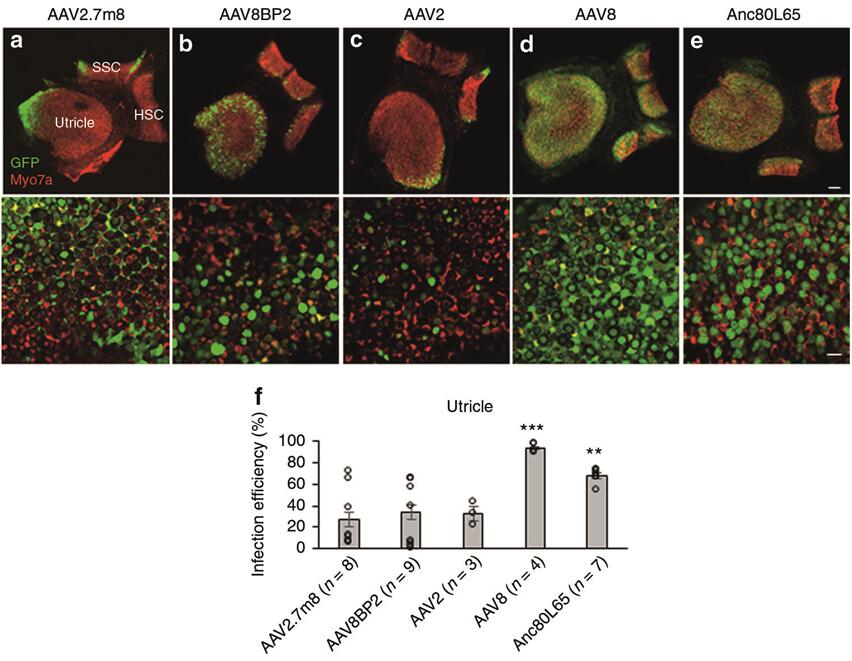 不同血清型AAV感染新生小鼠前庭HCs