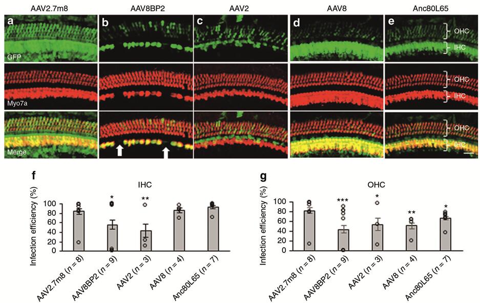 不同血清型AAV感染新生小鼠耳蜗HCs
