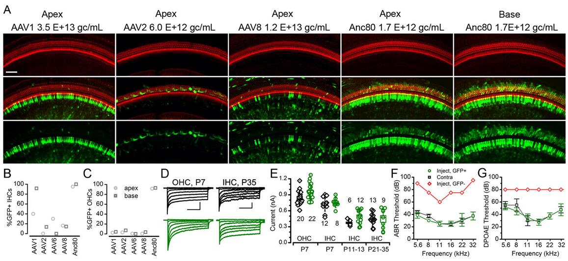 不同血清型AAV感染新生小鼠耳蜗HCs