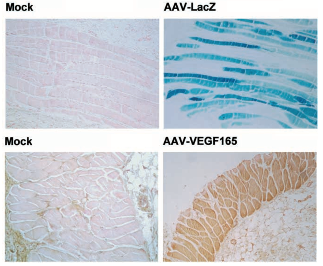 AAV-LacZ/VEGF165在大鼠皮肤中的表达