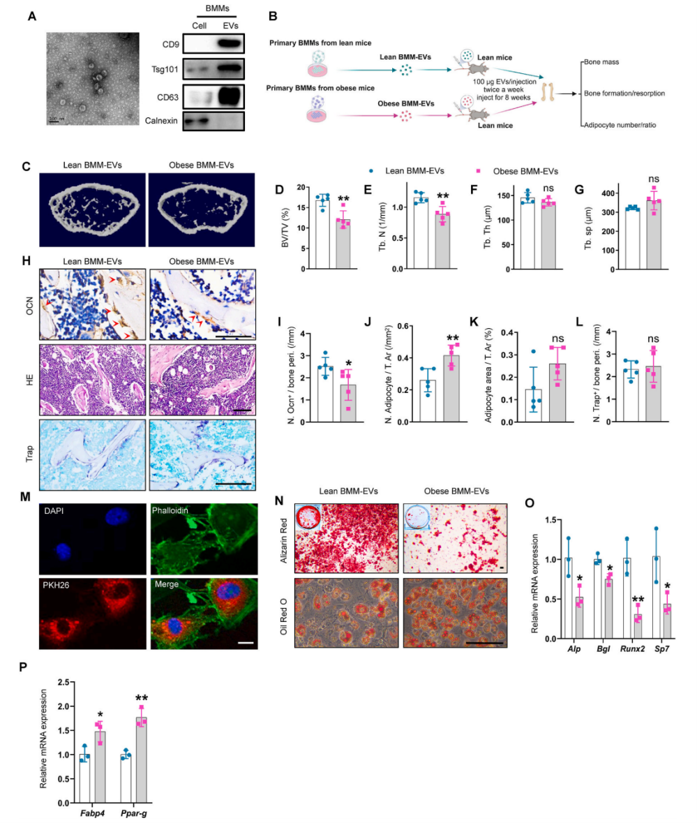 肥胖BMM-EVs诱导瘦小鼠骨质退化