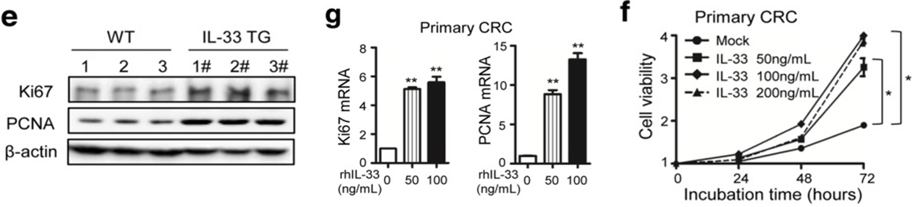 IL-33促进肿瘤细胞增殖