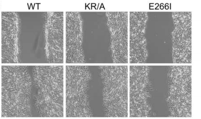 细胞迁移结果实例