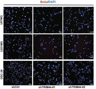 BrdU检测U87MG、U251MG和GSC-3#敲低TRIM44基因后对细胞增殖的影响