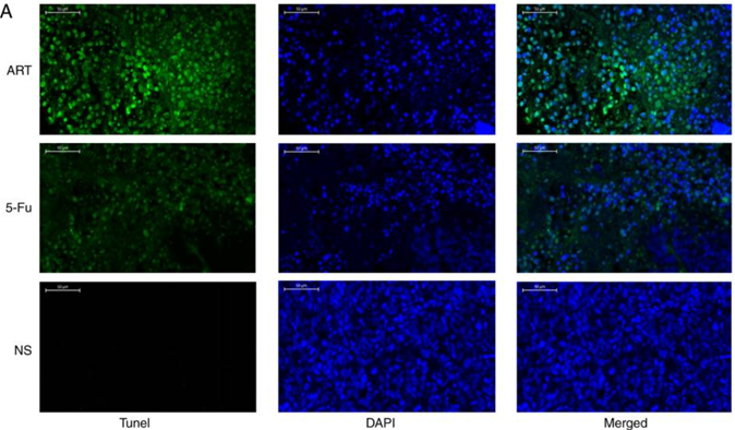 TUNEL染色检测细胞凋亡