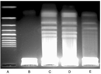 凋亡细胞的DNA电泳结果图