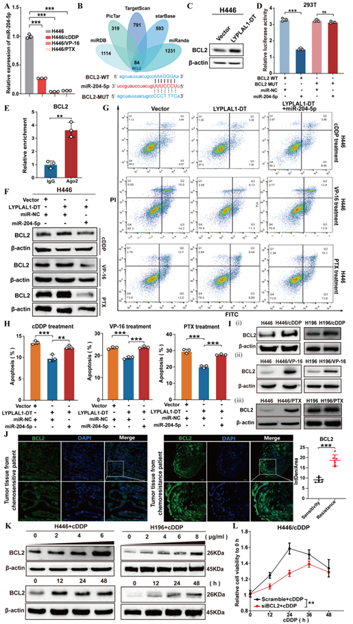 LYPLAL1-DT/BCL2/miR-204-5p轴参与SCLC细胞的化疗耐药