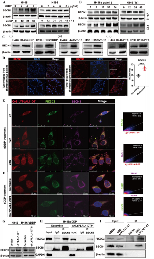 LYPLAL1-DT促进自噬核心参与者BECN1/PIK3C3复合物组装