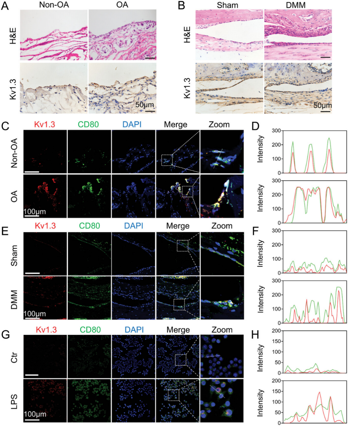 Kv1.3在OA患者和小鼠OA模型滑膜中的M1巨噬细胞中高表达