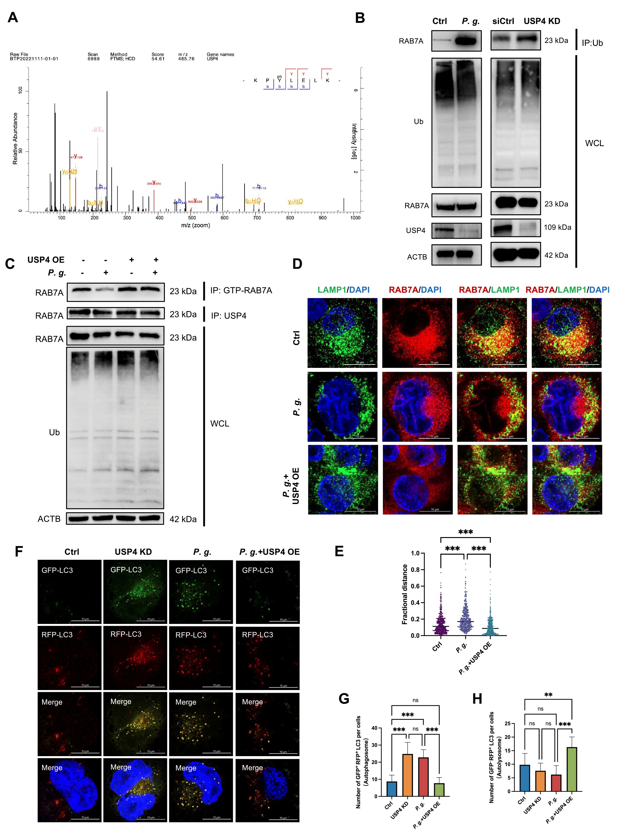USP4通过调节RAB7A去泛素化促进自噬体-溶酶体融合