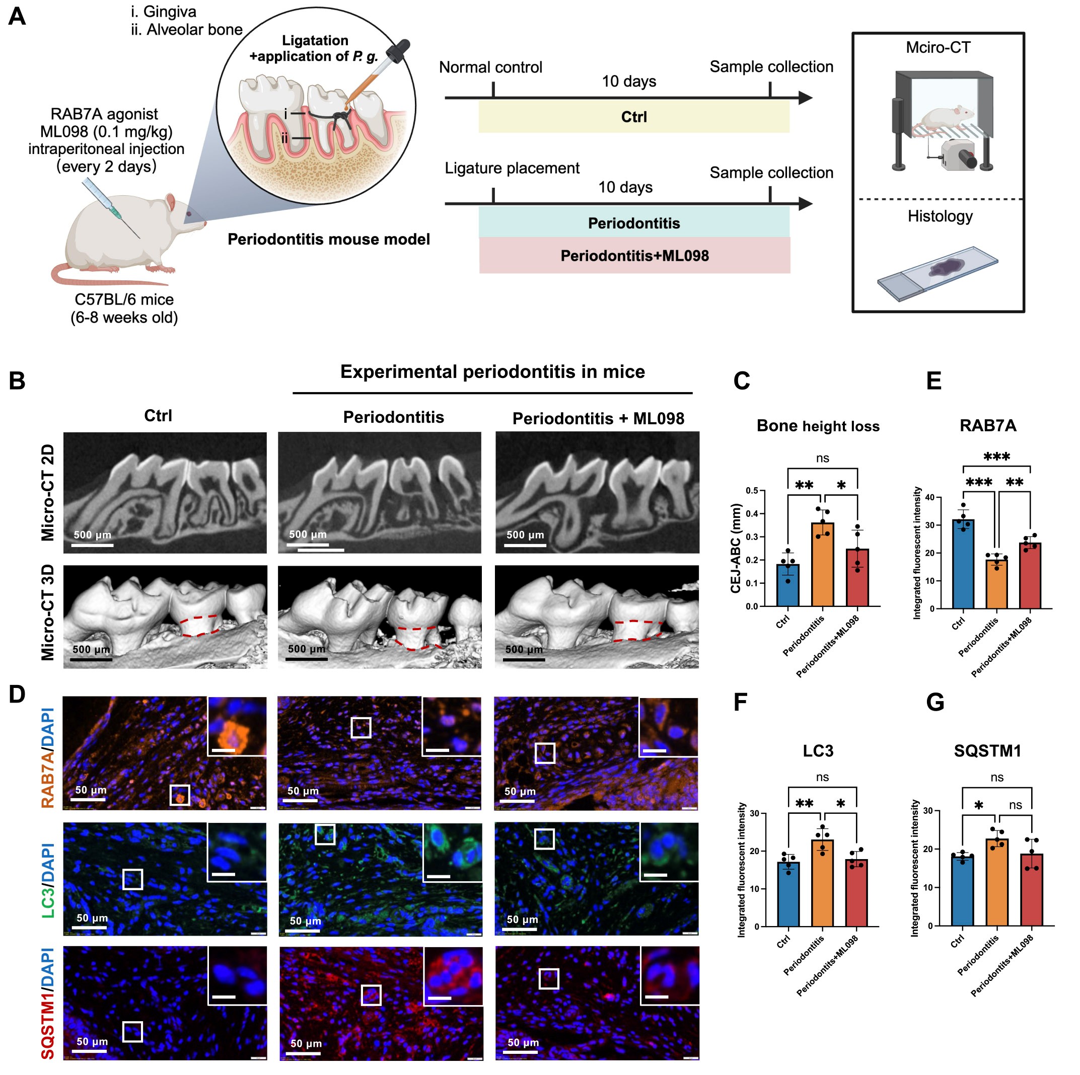 RAB7A激动剂ML098促进自噬并抑制牙周炎小鼠的牙槽骨流失