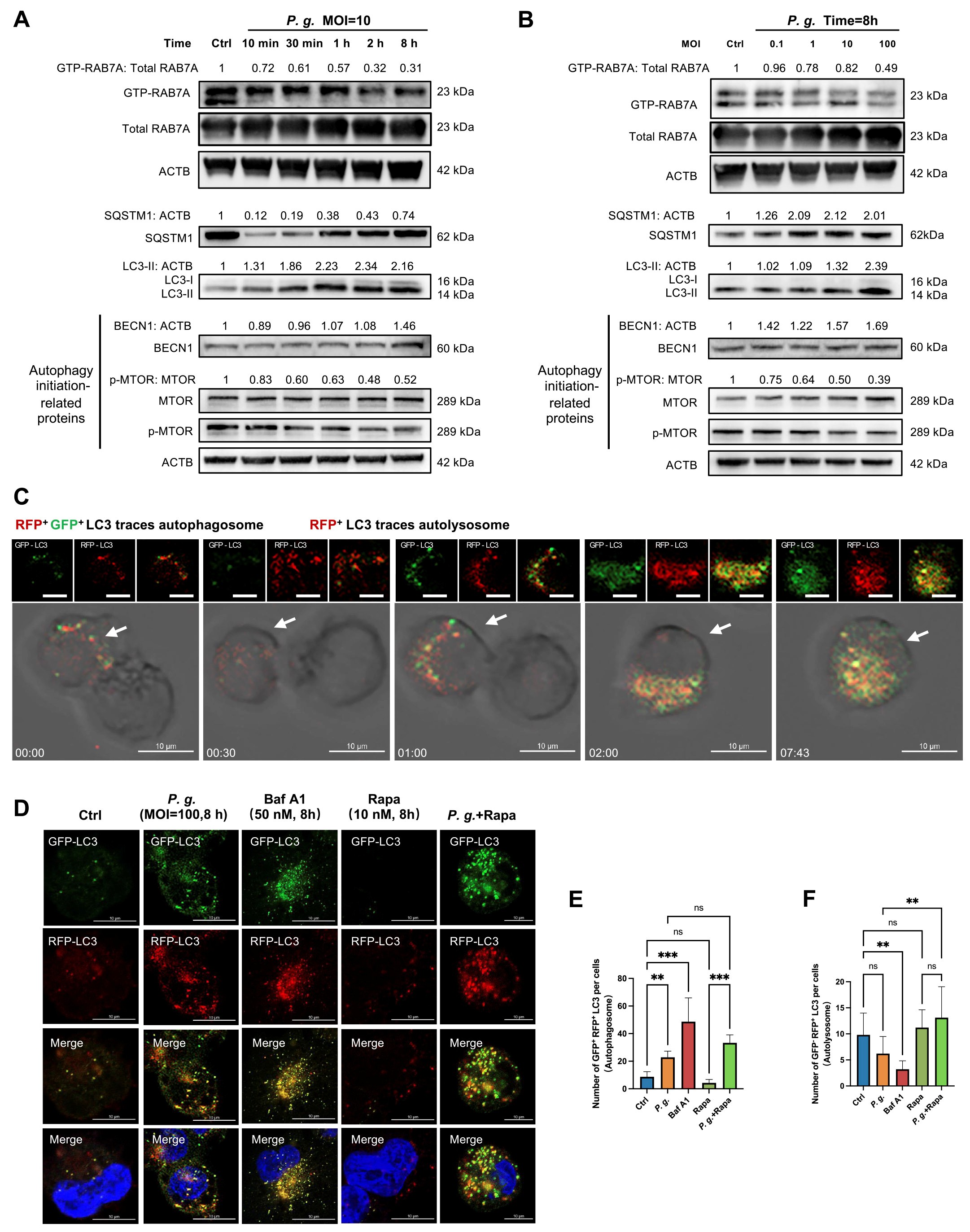 巨噬细胞中自噬损伤是通过阻断自噬体-溶酶体融合所介导