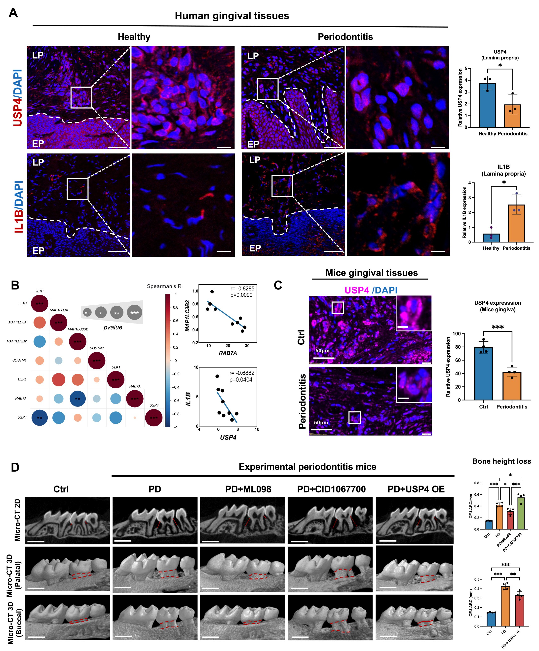 USP4的减少与牙周炎中IL-1B表达的增强有关