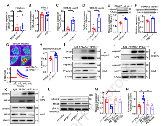 内皮PP2A缺乏促进钙蛋白酶2介导的MPST降解