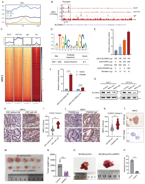 NRF2通过转录调节SLC38A2促进CRC细胞对谷氨酰胺的摄取
