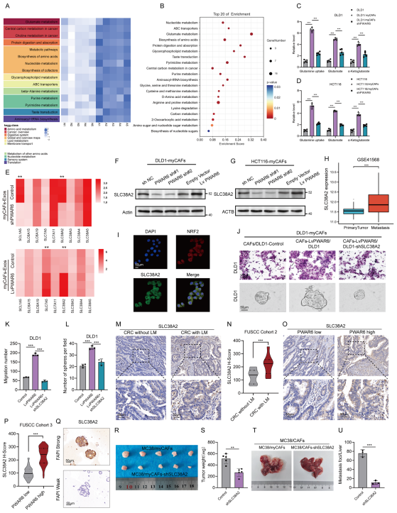 myCAF来源的exo-PWAR6通过上调SLC38A2增强CRC细胞的谷氨酰胺摄取