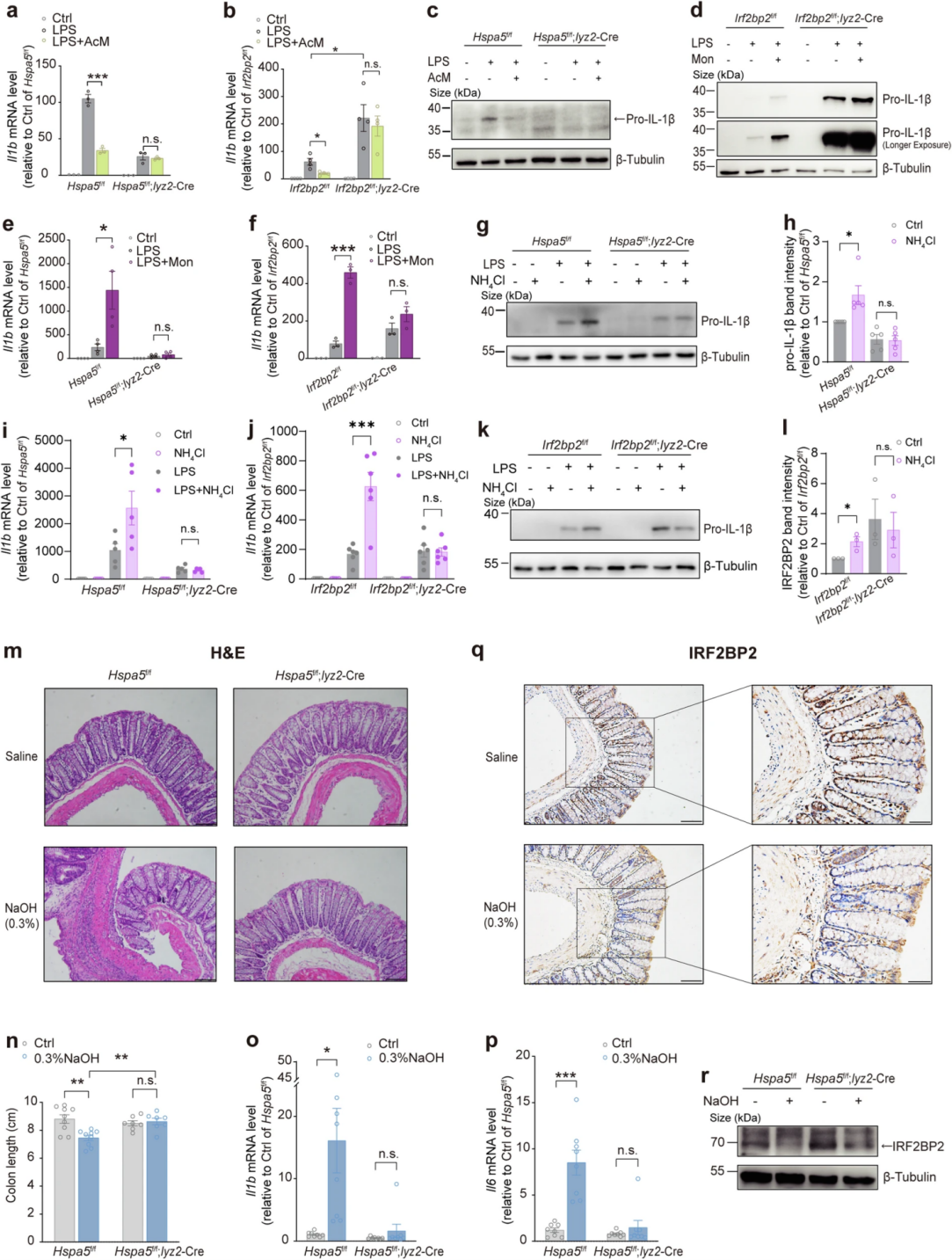 pH值变化可通过BiP-IRF2BP2轴调节炎症