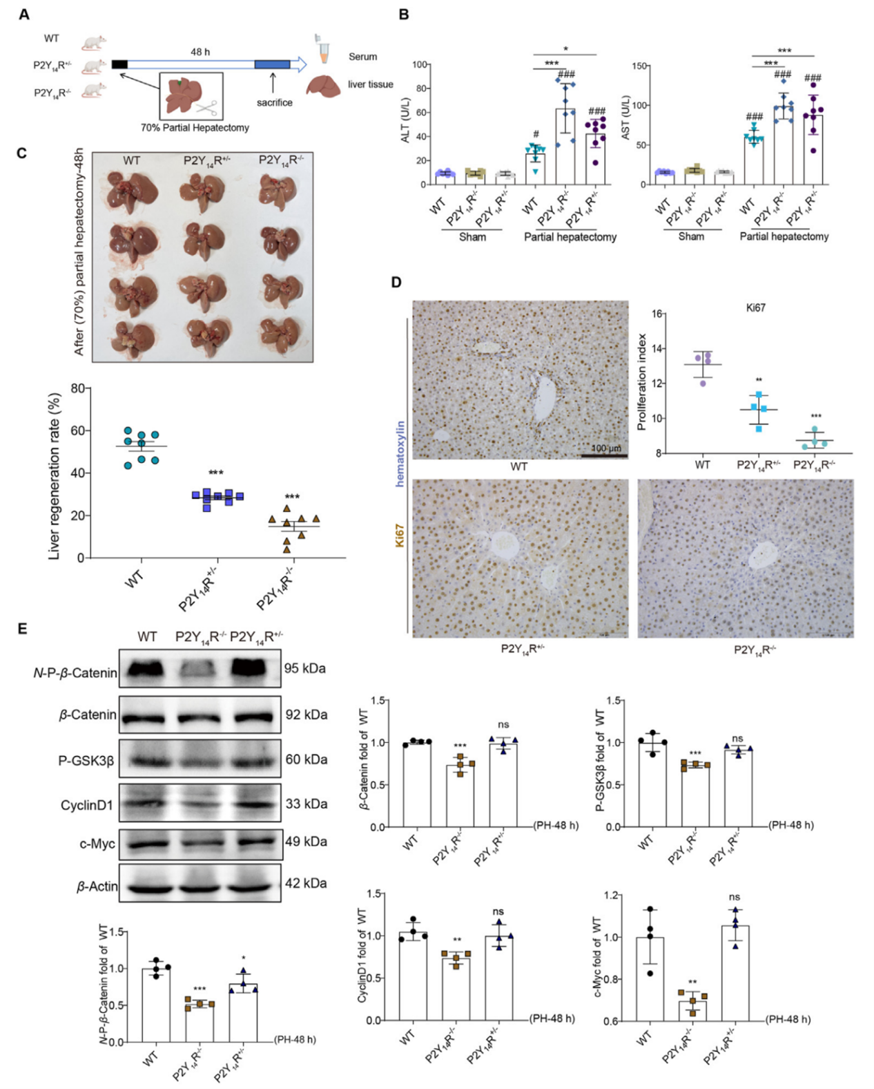 P2Y14R不足抑制部分肝切除术后的肝脏再生