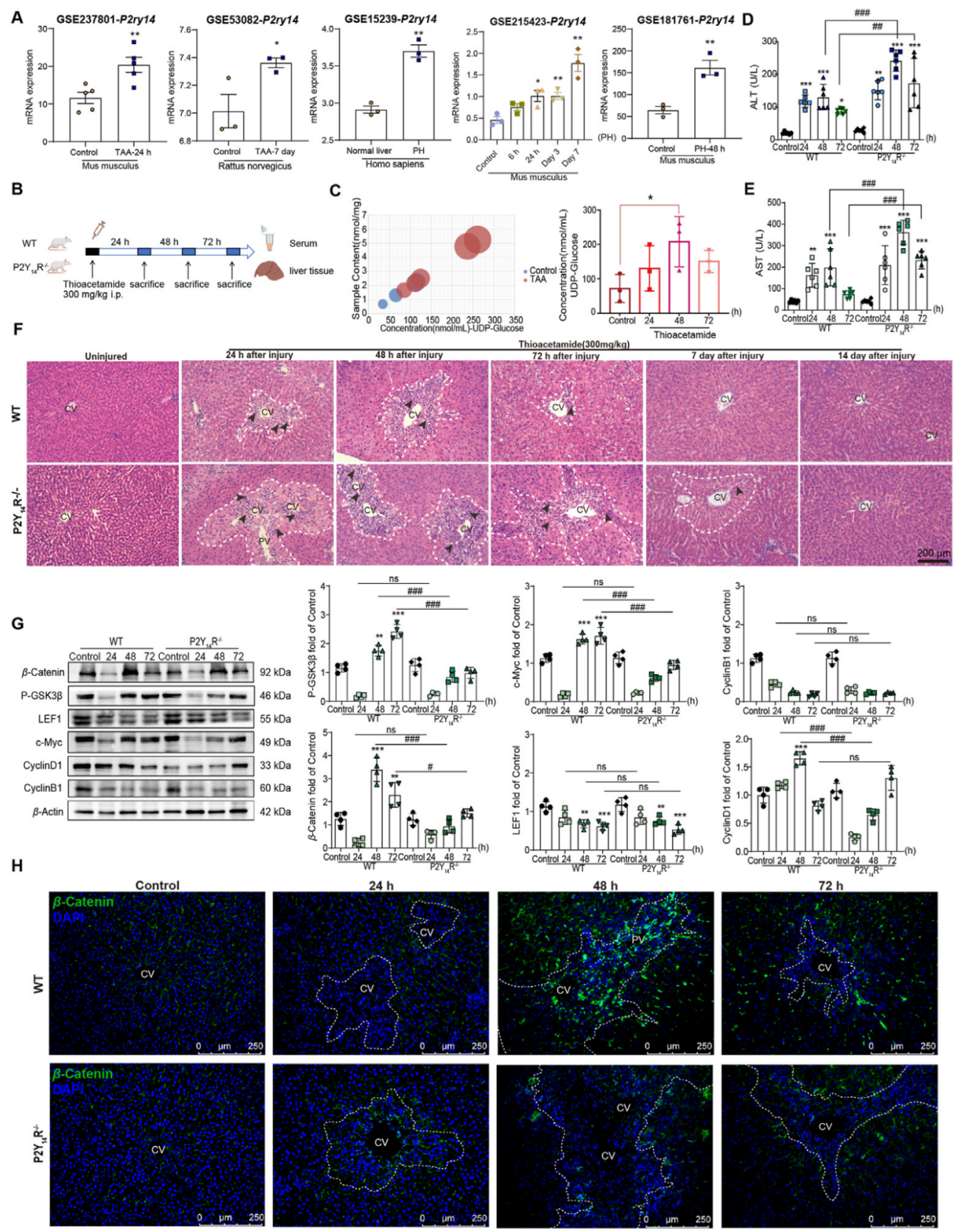 P2Y14R敲除通过抑制β-Catenin信号通路加重TAA诱导的ALF