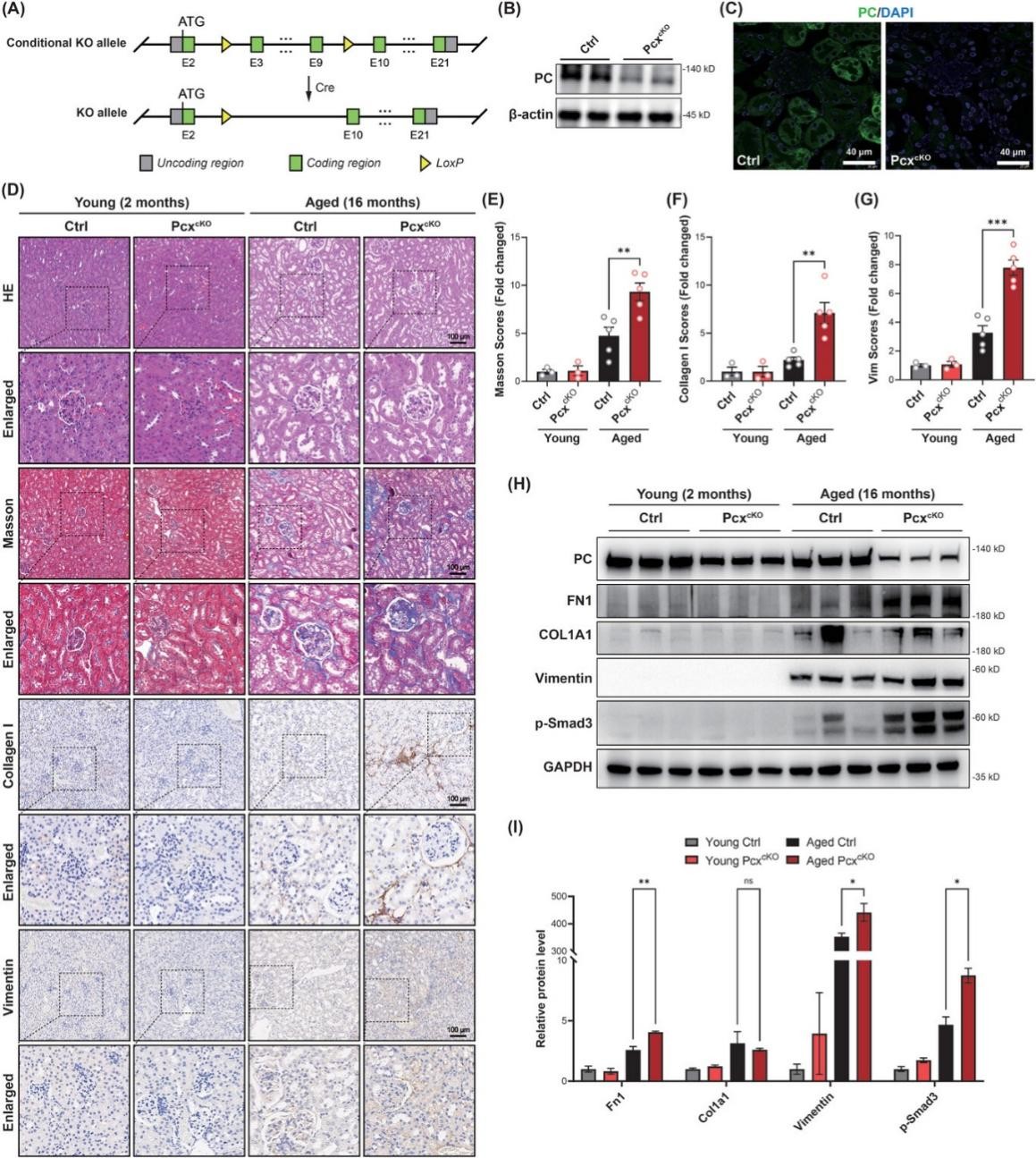 Pcx缺乏会诱发自发性肾脏纤维化