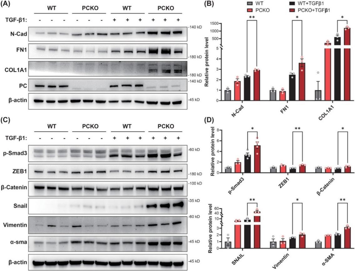 PC缺乏可加剧 TGF-β1 诱导的 HK-2 细胞纤维化
