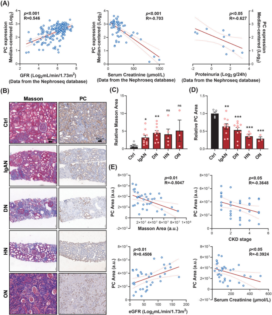 PC的表达与CKD患者的肾功能和肾纤维化相关