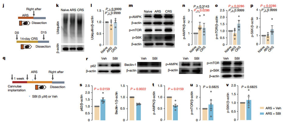 应激对LHb自噬调节的信号通路