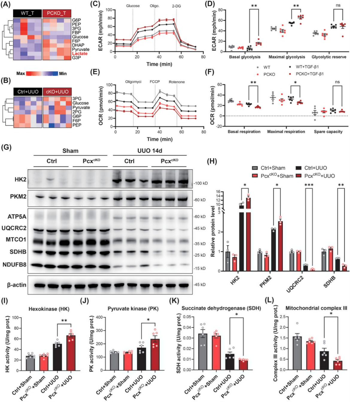 PC基因敲除增加了糖酵解过程相关基因表达水平