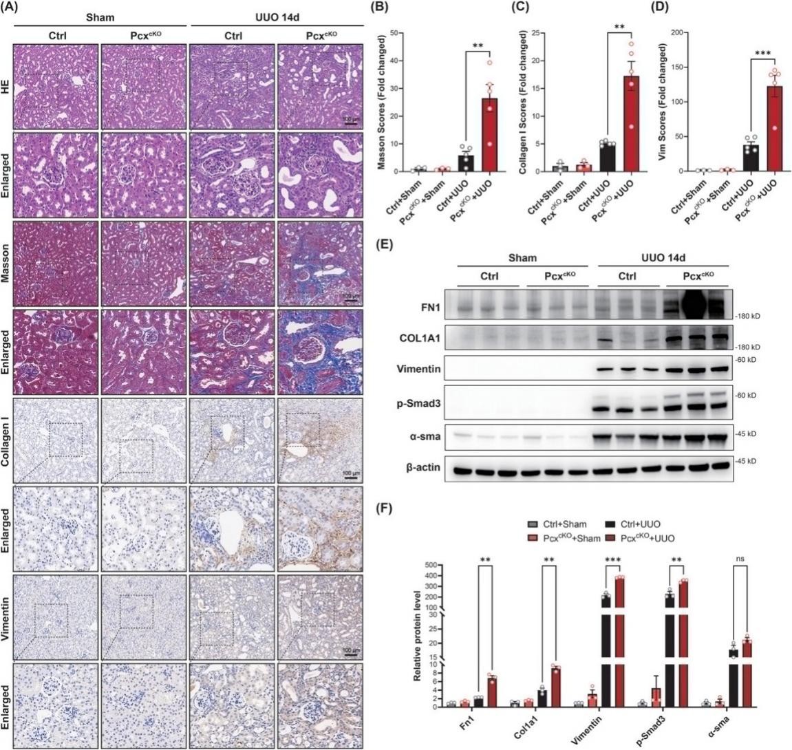 肾小管上皮细胞中PC的条件性基因敲除会加剧UUO诱发的肾脏纤维化