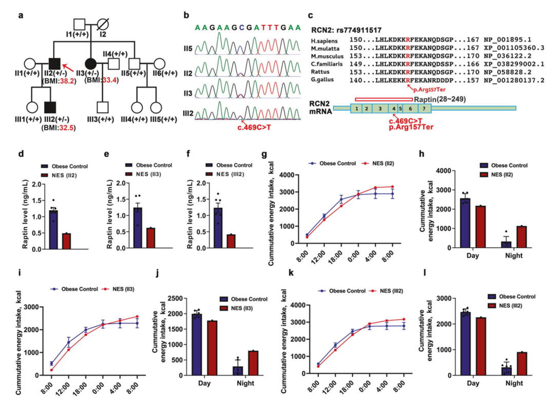 RCN2无义突变导致NES