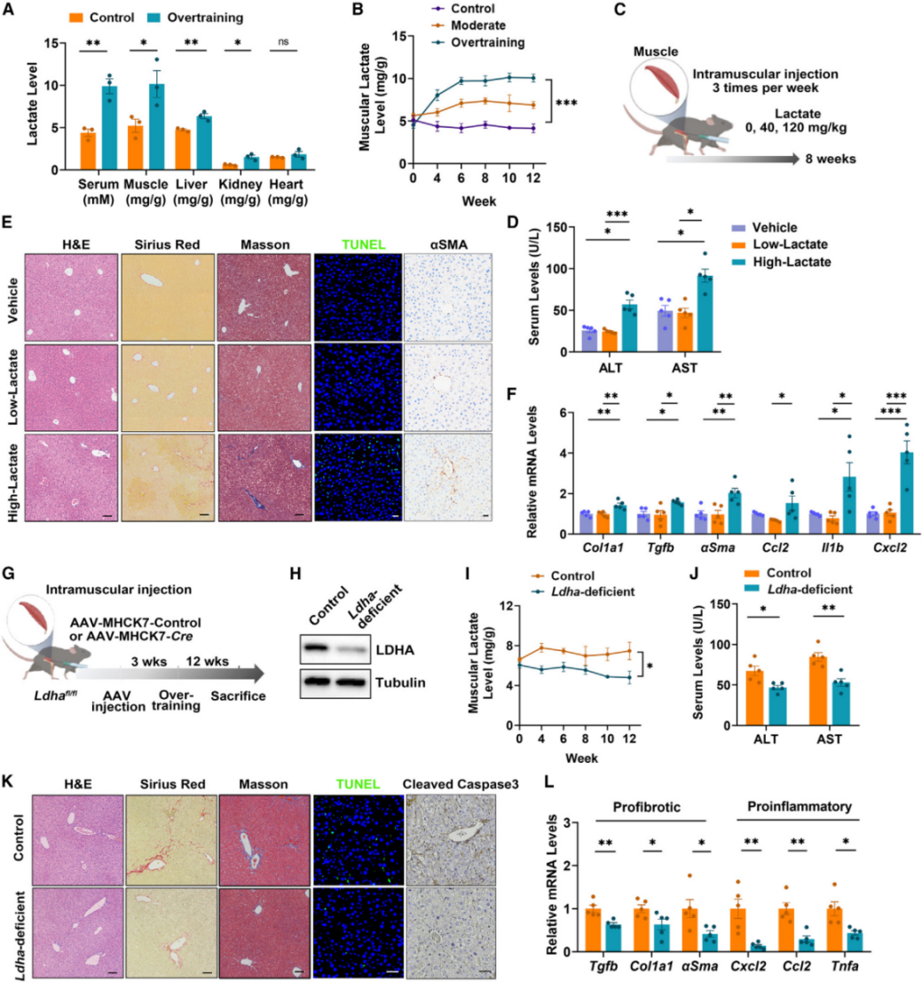 乳酸在肌肉中的积累会导致肝纤维化