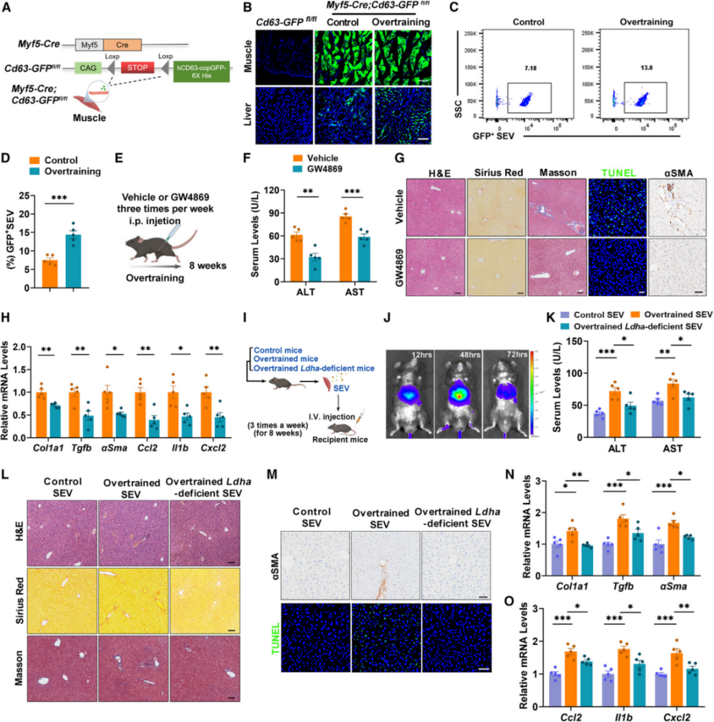 乳酸促进肌肉源性SEVs向肝脏转移并加剧肝纤维化