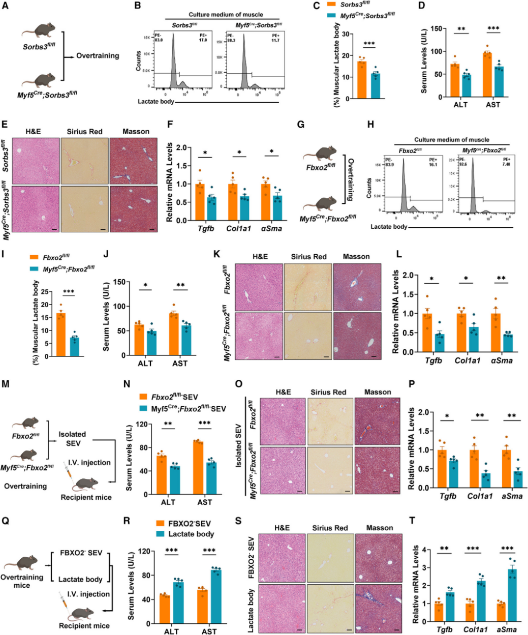 肌源性乳酸体诱导肝纤维化
