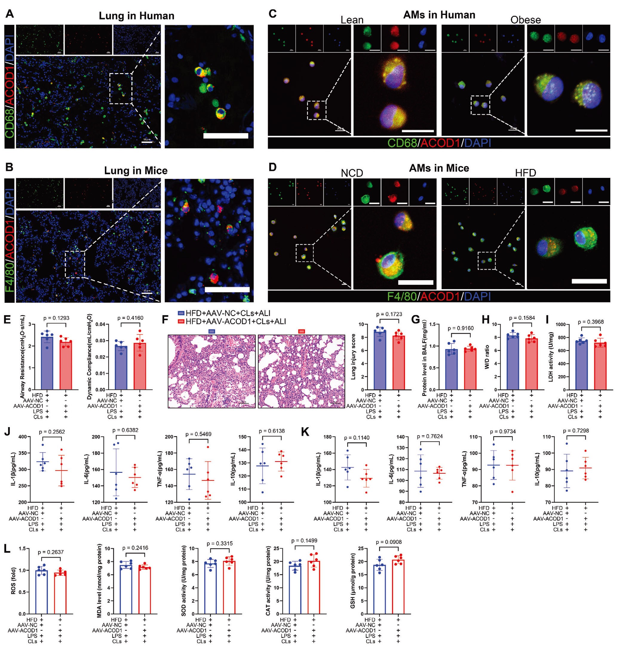 ACOD1介导的肥胖相关ALI的保护作用依赖巨噬细胞
