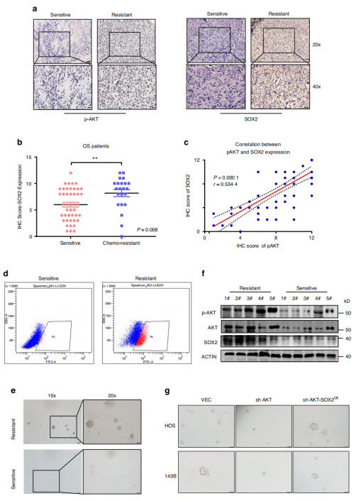 AKT-SOX2轴在化疗耐药的OS中具有正向调控作用