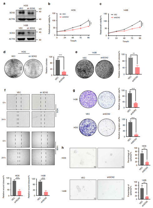 体外实验中，SOX2可促进OS细胞的增殖、迁移以及成球能力
