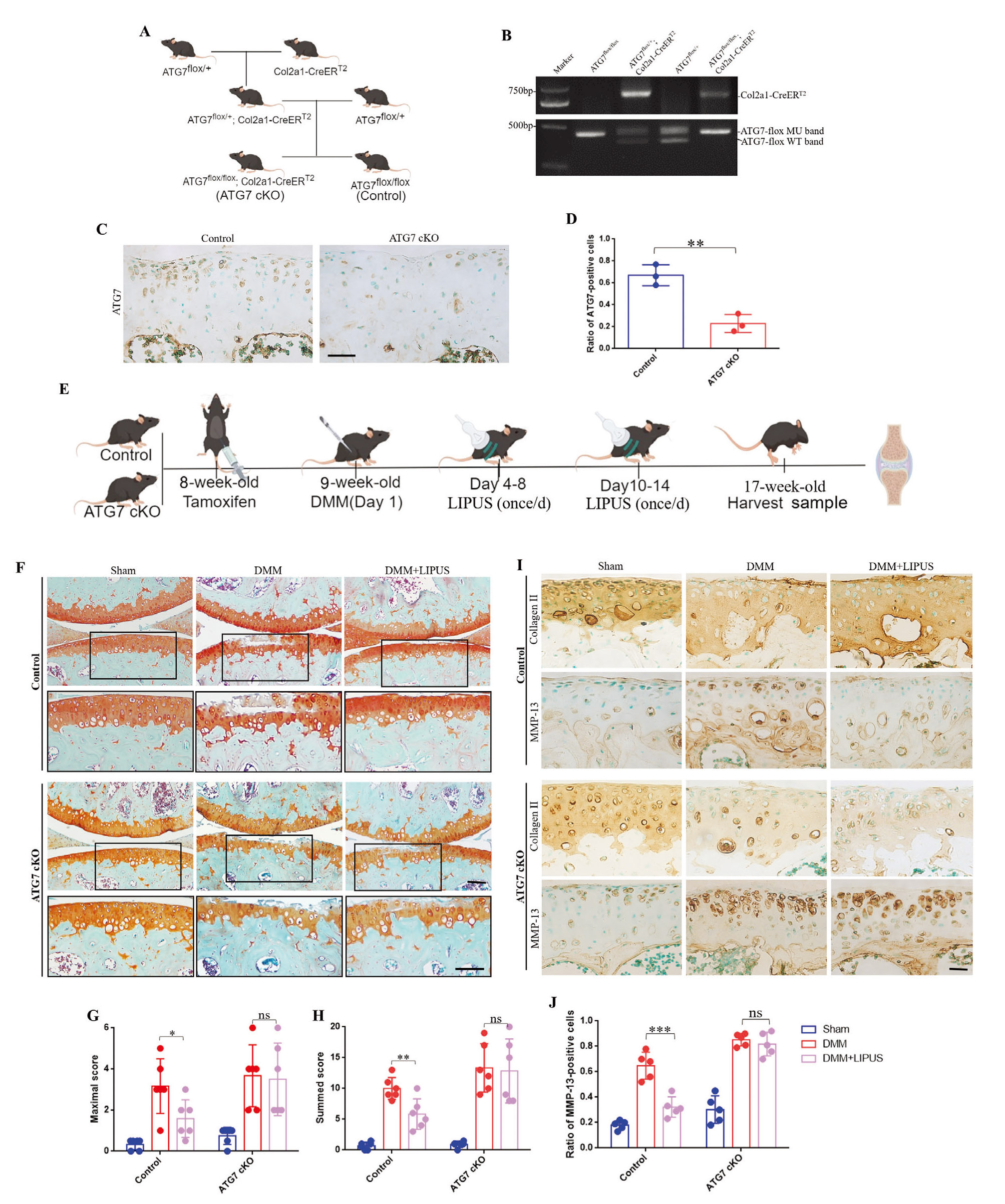 LIPUS通过自噬维持软骨稳态
