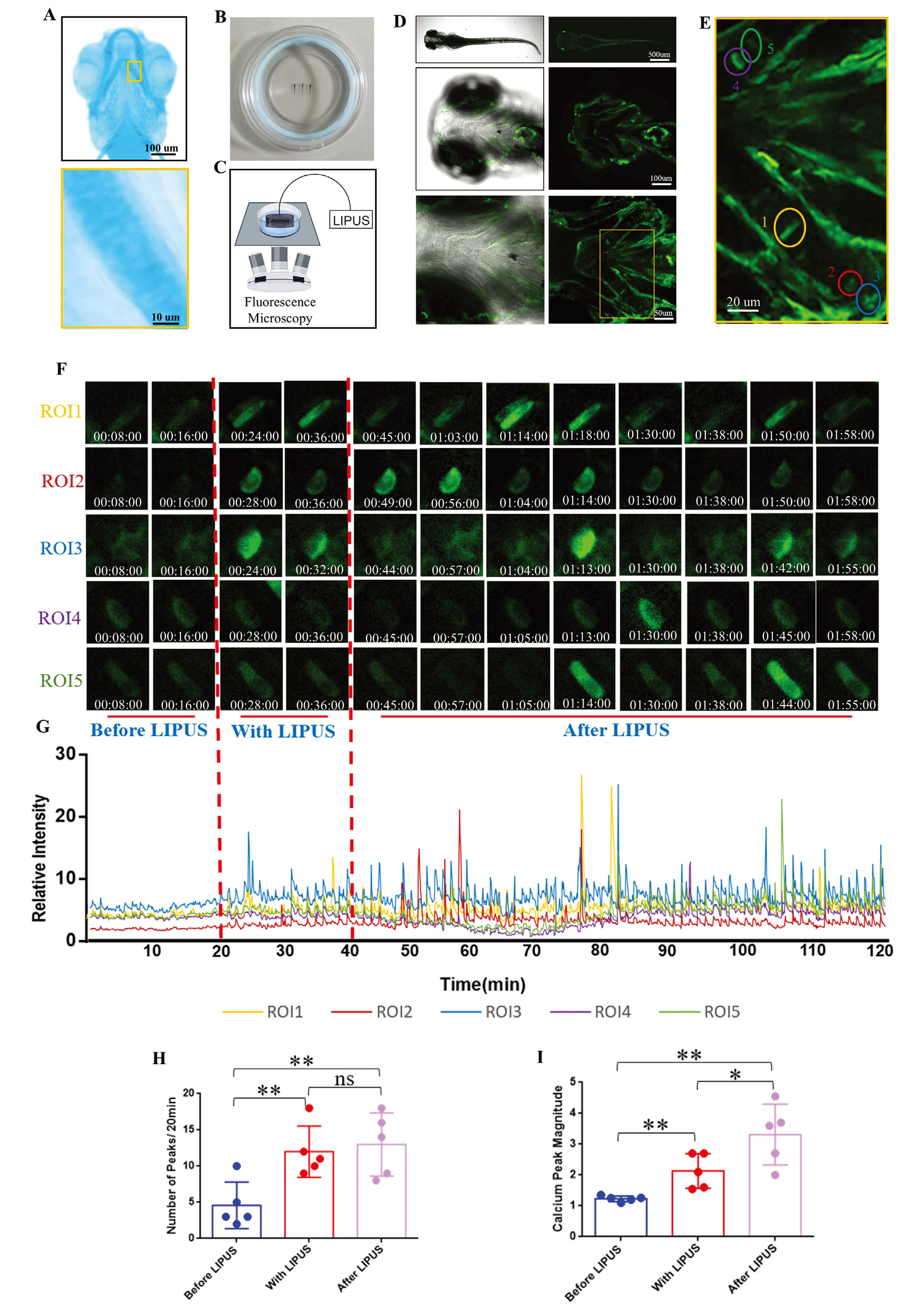 LIPUS促进活体斑马鱼软骨细胞钙振荡