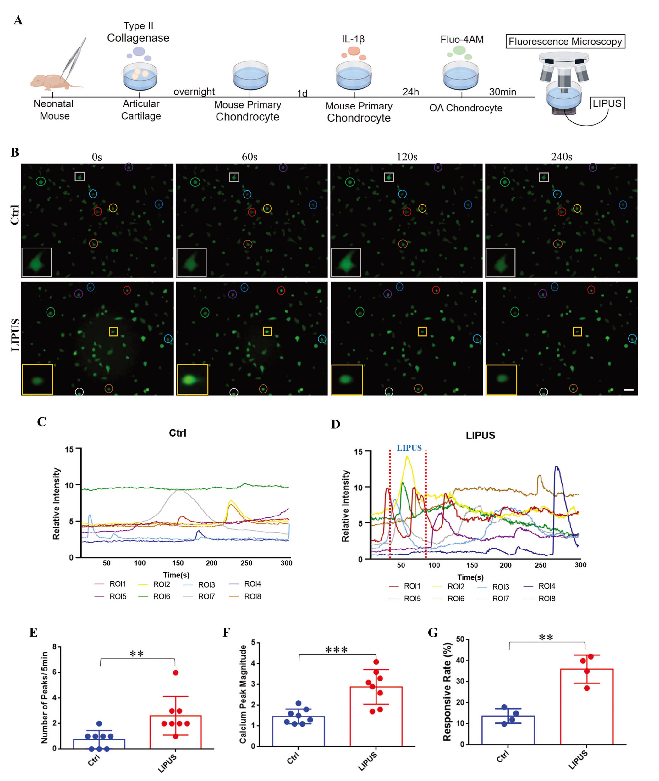LIPUS激活炎症软骨细胞的Ca2+信号