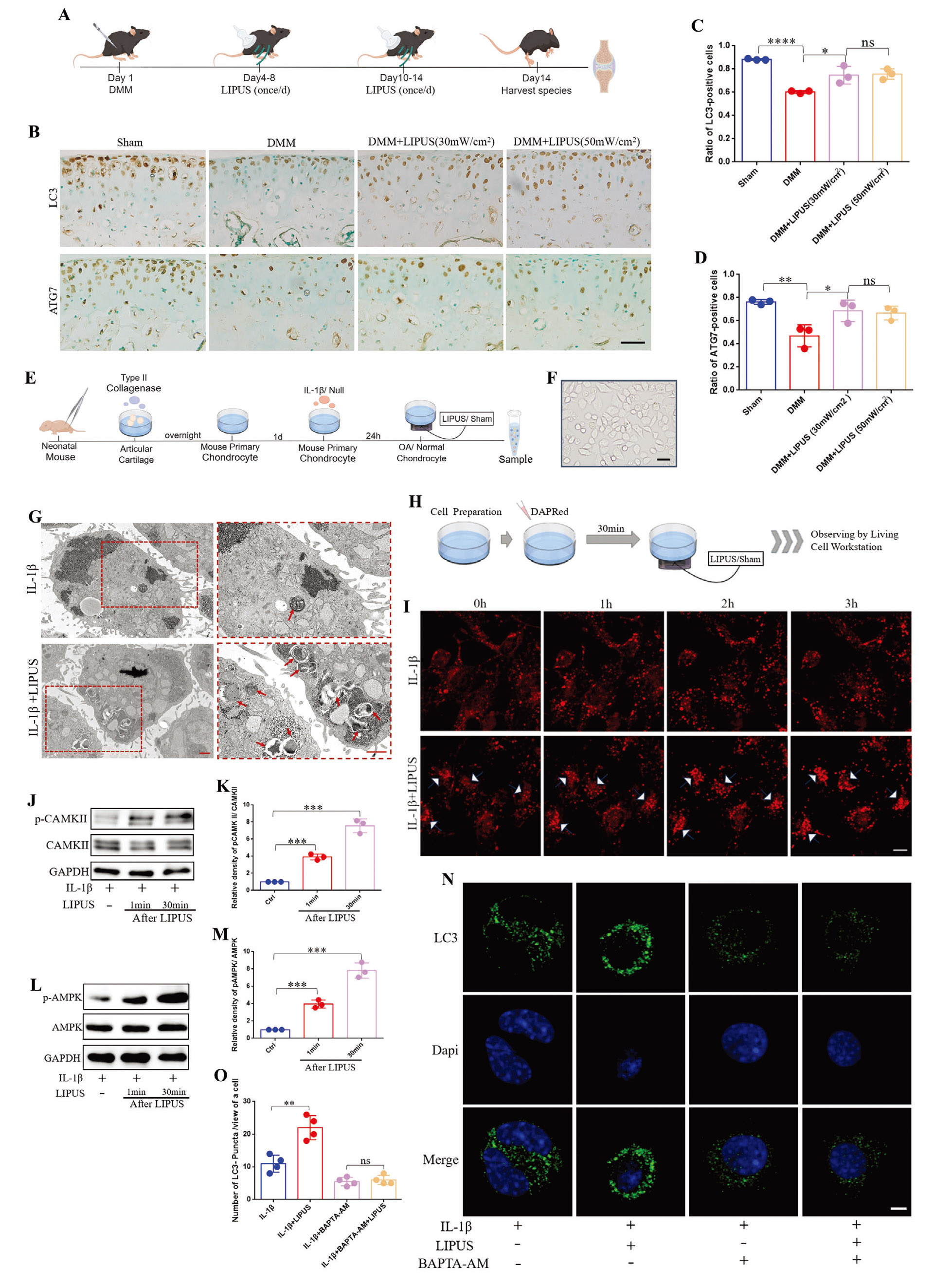 LIPUS通过钙依赖方式上调软骨细胞自噬