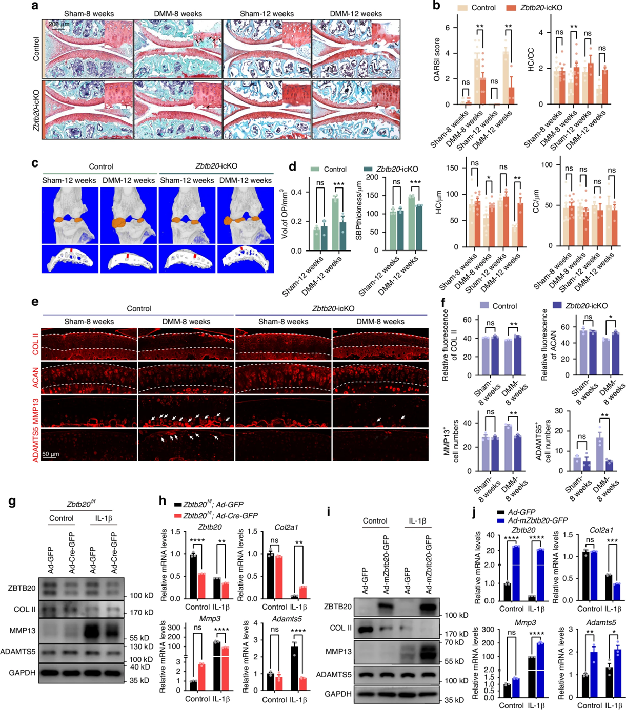 ZBTB20的下调减弱OA发展