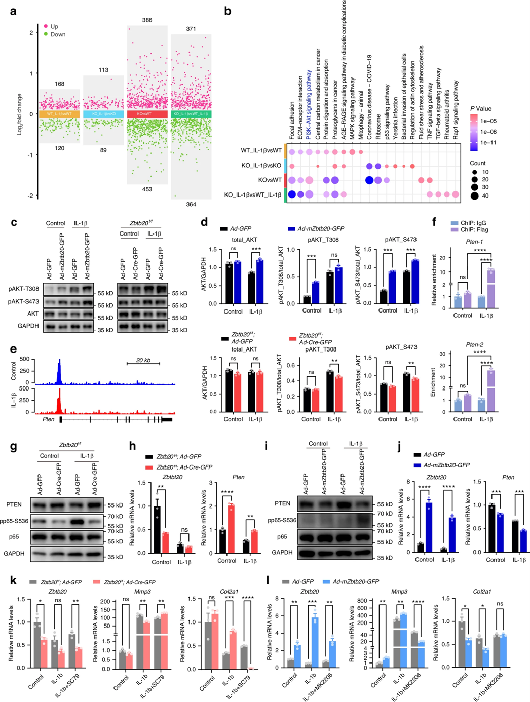 ZBTB20通过抑制Pten激活NF-κB信号
