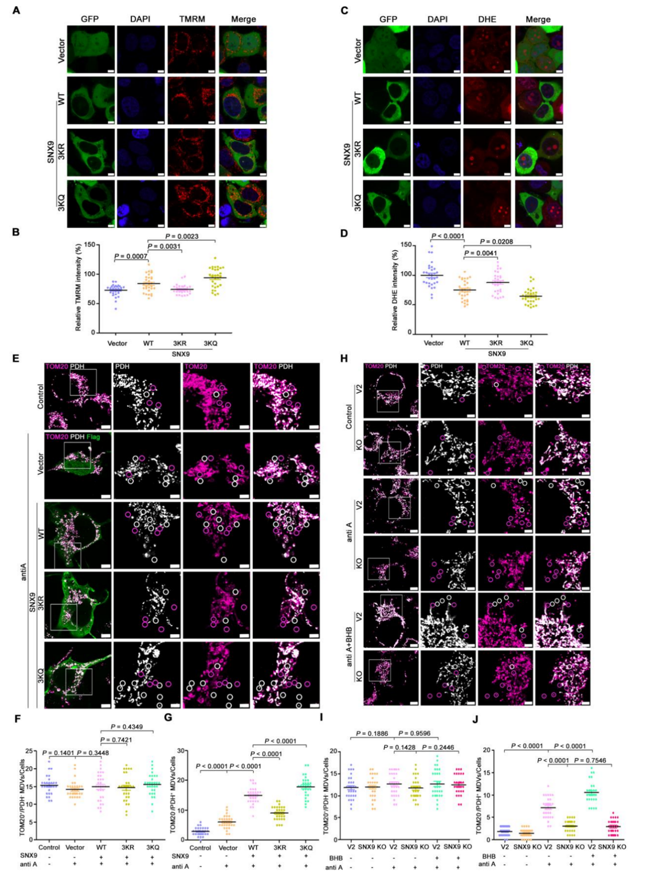 SNX9 3KQ独立于线粒体自噬调节线粒体功能