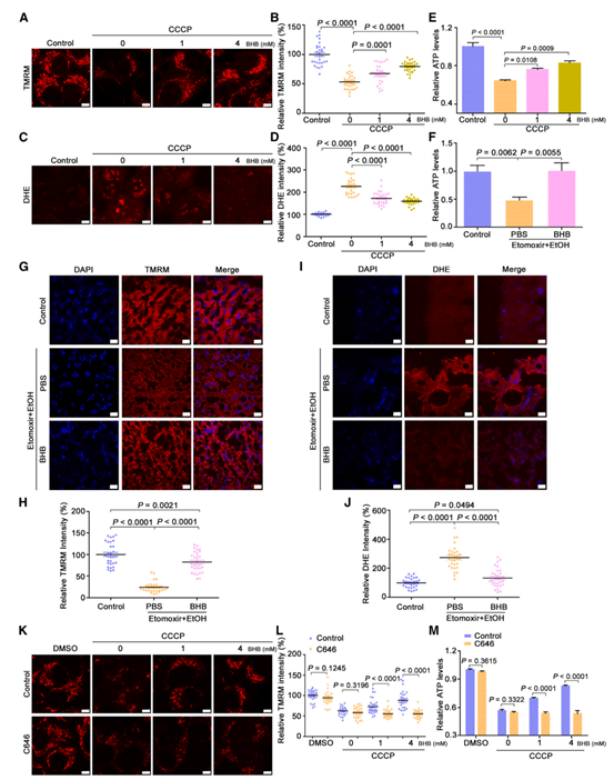 BHB保护细胞和小鼠肝脏免受应激诱导的线粒体损伤