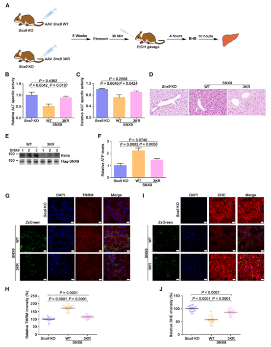 SNX9 Kbhb对小鼠酒精性肝损伤的保护作用