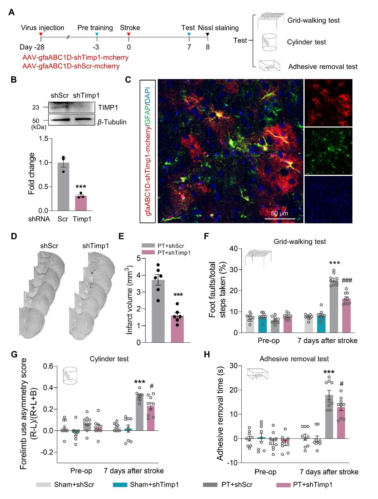 下调星形细胞TIMP1的表达，可改善PT小鼠功能恢复