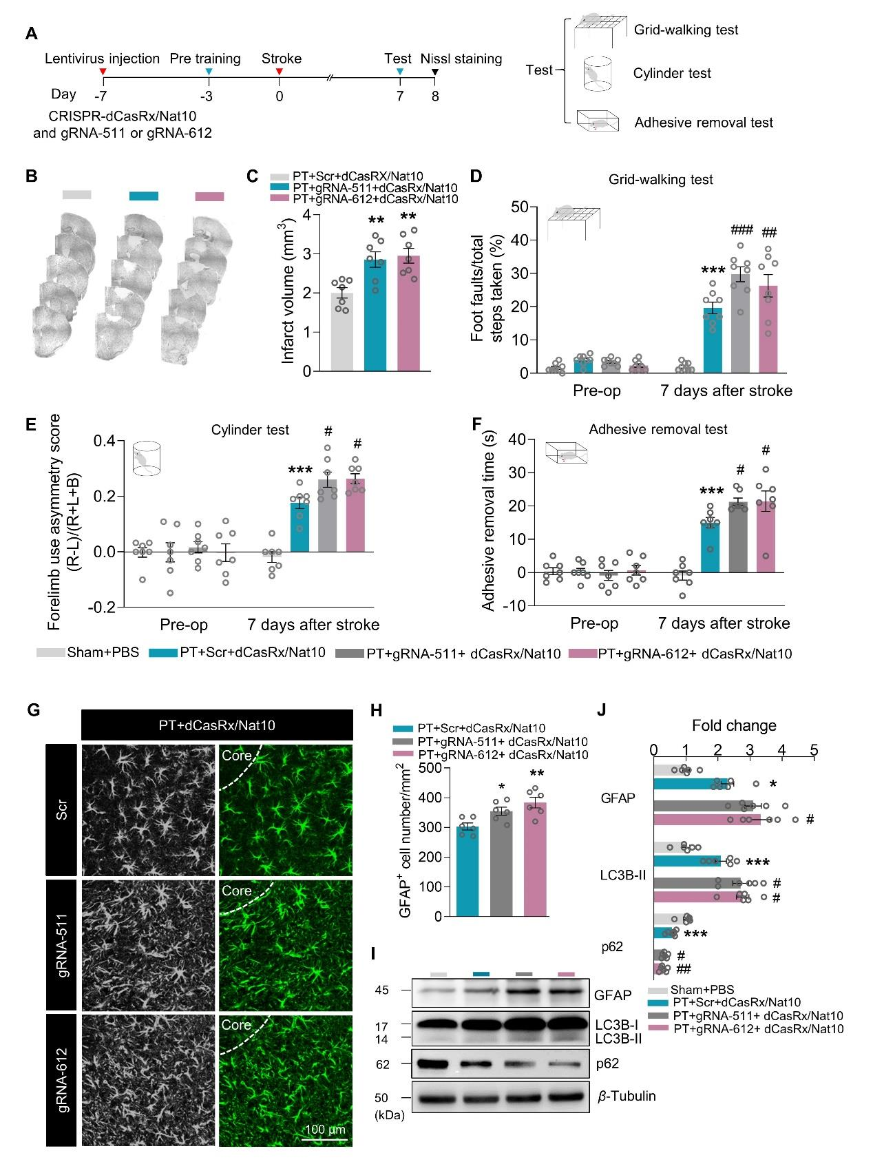 NAT10通过对TIMP1表达调控，影响PT老鼠脑功能恢复